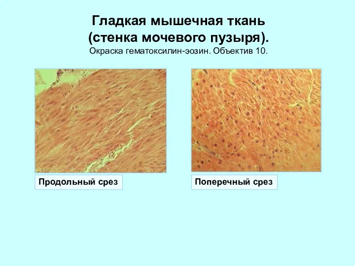 Гладкая мышечная ткань (стенка мочевого пузыря). Окраска гематоксилин-эозин. Объектив 10. Продольный срез Поперечный срез