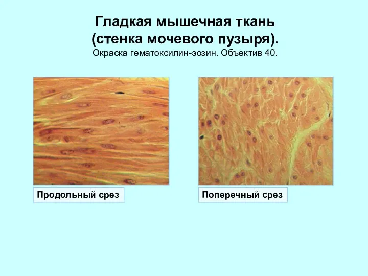 Гладкая мышечная ткань (стенка мочевого пузыря). Окраска гематоксилин-эозин. Объектив 40. Продольный срез Поперечный срез