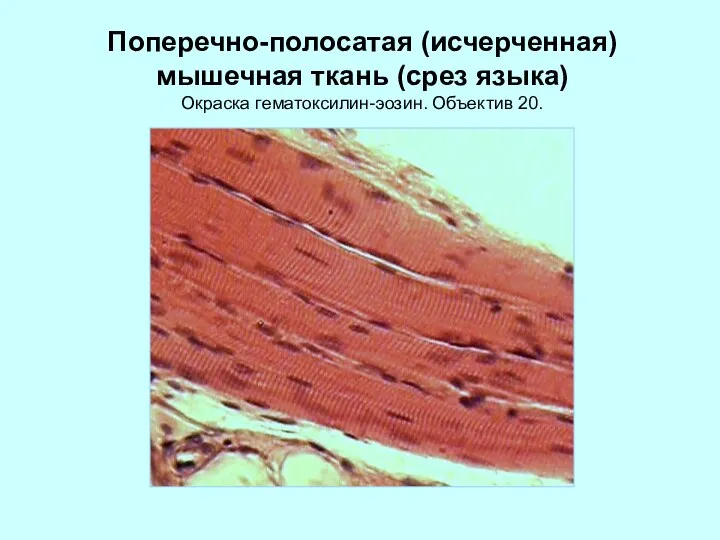 Поперечно-полосатая (исчерченная) мышечная ткань (срез языка) Окраска гематоксилин-эозин. Объектив 20.