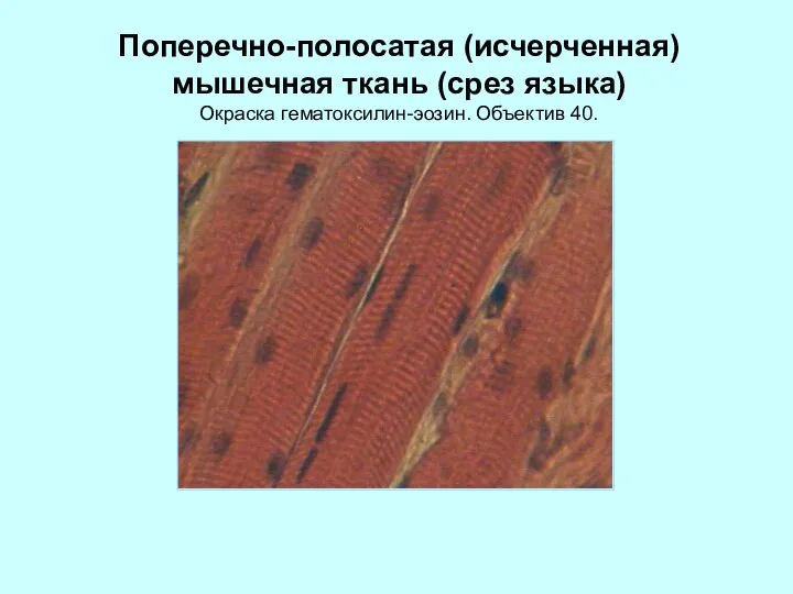 Поперечно-полосатая (исчерченная) мышечная ткань (срез языка) Окраска гематоксилин-эозин. Объектив 40.