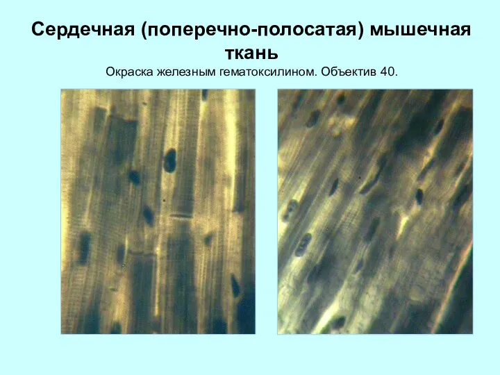 Сердечная (поперечно-полосатая) мышечная ткань Окраска железным гематоксилином. Объектив 40.