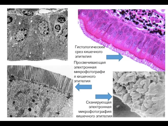 Гистологический срез кишечного эпителия Сканирующая электронная микрофотография кишечного эпителия Просвечивающая электронная микрофотография кишечного эпителия