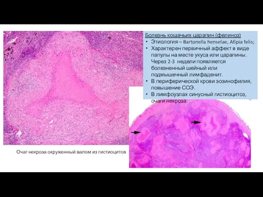 Болезнь кошачьих царапин (фелиноз) Этиология – Bartonella henselae, Afipia felis; Характерен первичный