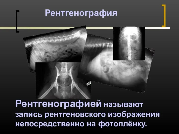 Рентгенография Рентгенографией называют запись рентгеновского изображения непосредственно на фотоплёнку.