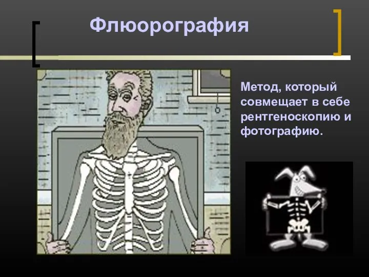 Флюорография Метод, который совмещает в себе рентгеноскопию и фотографию.