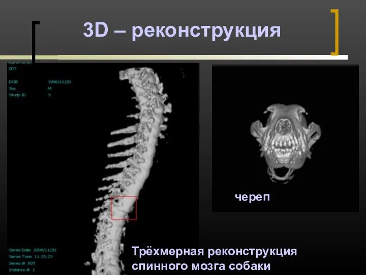 3D – реконструкция Трёхмерная реконструкция спинного мозга собаки череп