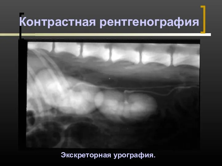 Контрастная рентгенография Экскреторная урография.