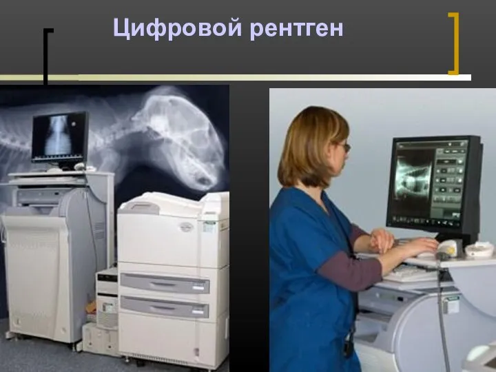 Цифровой рентген