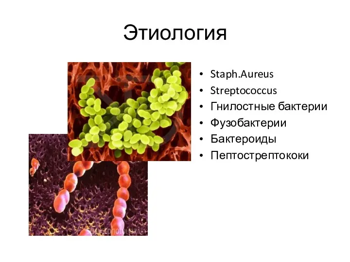 Этиология Staph.Aureus Streptococcus Гнилостные бактерии Фузобактерии Бактероиды Пептострептококи