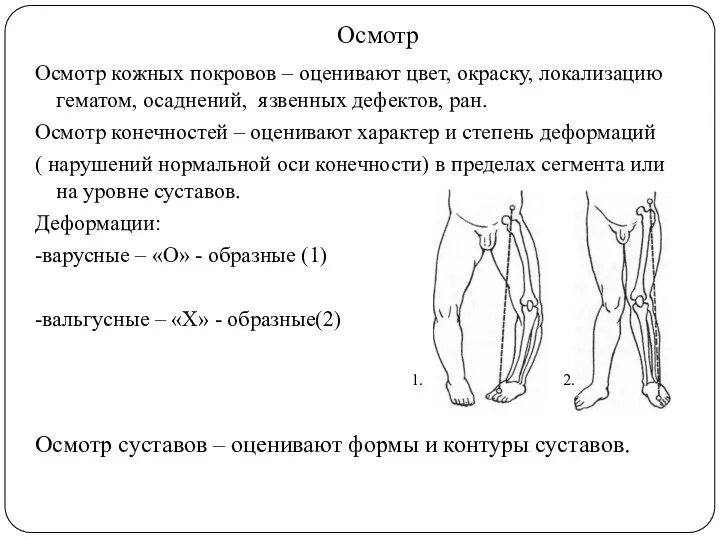 Осмотр Осмотр кожных покровов – оценивают цвет, окраску, локализацию гематом, осаднений, язвенных