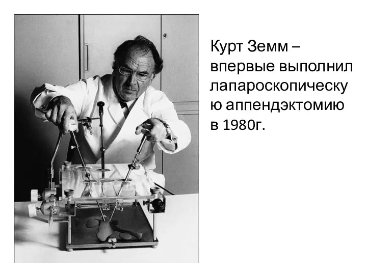 Курт Земм – впервые выполнил лапароскопическую аппендэктомию в 1980г.