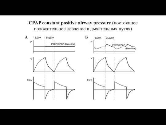 CPAP constant positive airway pressure (постоянное положительное давление в дыхательных путях)