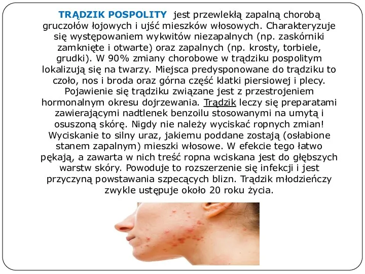 TRĄDZIK POSPOLITY jest przewlekłą zapalną chorobą gruczołów łojowych i ujść mieszków włosowych.