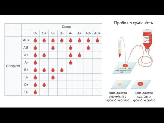 Проба на сумісність кров донора несумісна з кров’ю хворого кров донора сумісна з кров’ю хворого