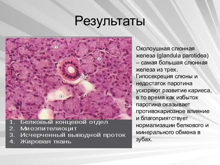 Результаты Околоушная слюнная железа (glandula parotidea) – самая большая слюнная железа из