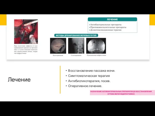 Лечение Восстановление пассажа мочи. Симптоматическая терапия Антибиотикотерапия, посев. Оперативное лечение.