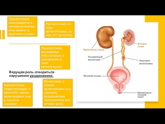 Ведущая роль отводиться нарушению уродинамики. Препятствия, находящиеся в мочеиспускательном канале и мочевом