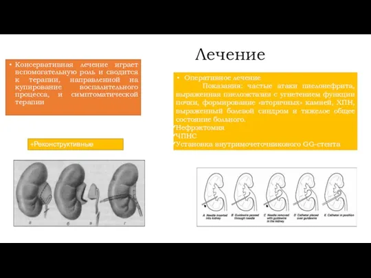 Лечение Консервативная лечение играет вспомогательную роль и сводится к терапии, направленной на