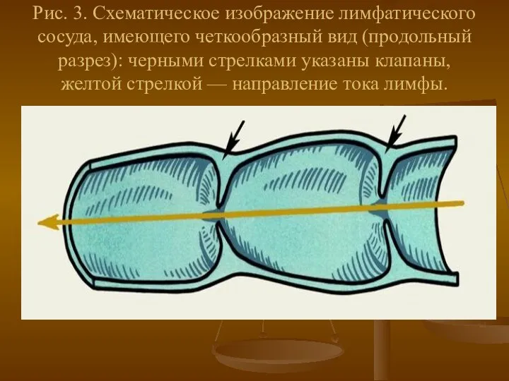 Рис. 3. Схематическое изображение лимфатического сосуда, имеющего четкообразный вид (продольный разрез): черными