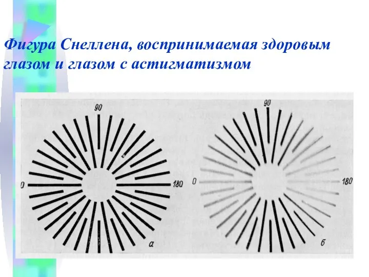 Фигура Снеллена, воспринимаемая здоровым глазом и глазом с астигматизмом