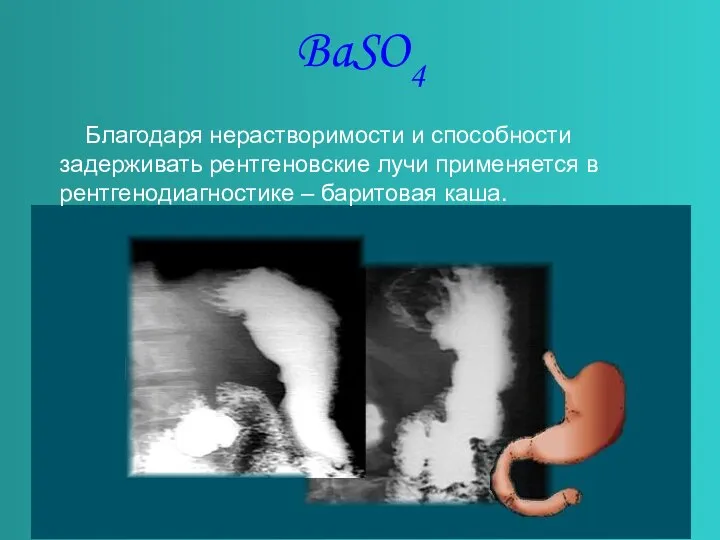 BaSO4 Благодаря нерастворимости и способности задерживать рентгеновские лучи применяется в рентгенодиагностике – баритовая каша.