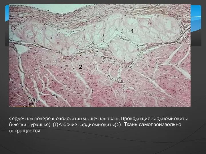 Сердечная поперечнополосатая мышечная ткань Проводящие кардиомиоциты(клетки Пуркинье) (1)Рабочие кардиомиоциты(2). Ткань самопроизвольно сокращается.