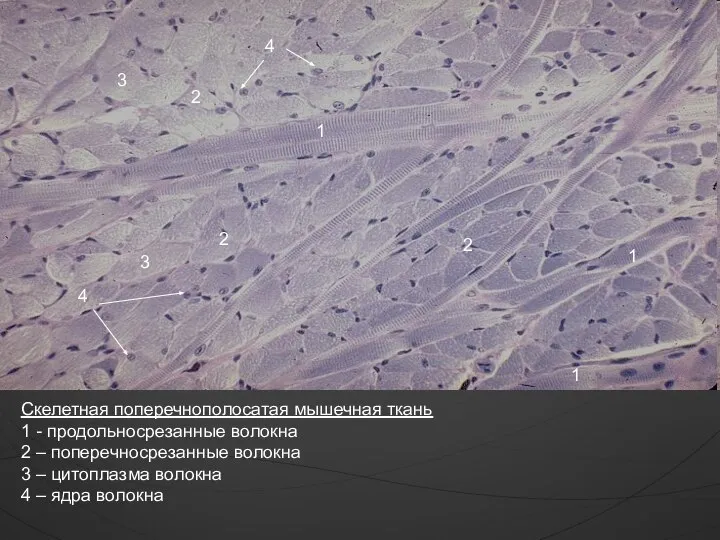 Скелетная поперечнополосатая мышечная ткань 1 - продольносрезанные волокна 2 – поперечносрезанные волокна