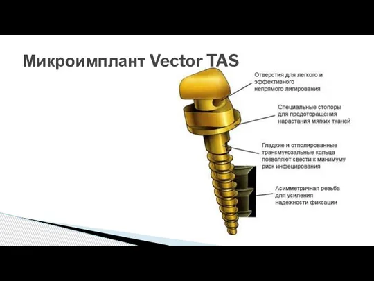 Микроимплант Vector TAS