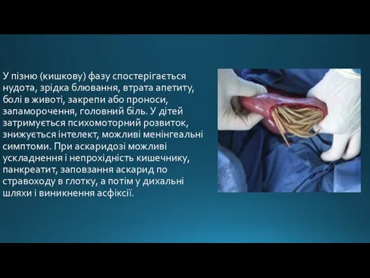 У пізню (кишкову) фазу спостерігається нудота, зрідка блювання, втрата апетиту, болі в