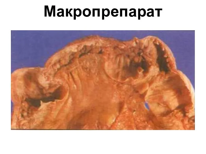 Макропрепарат