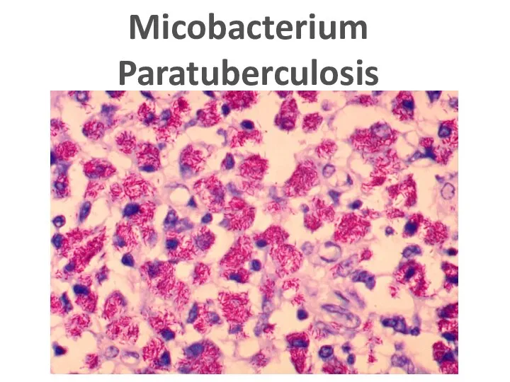 Micobacterium Paratuberculosis