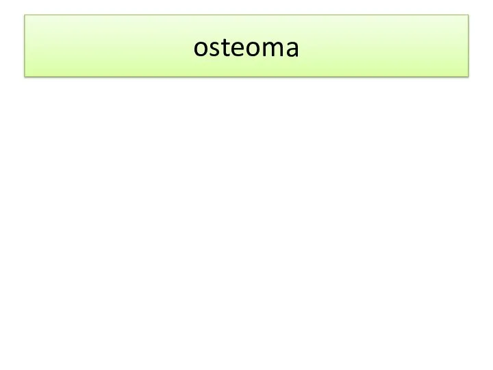 osteoma