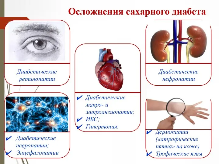 Осложнения сахарного диабета Диабетические нефропатии Диабетические макро- и микроангиопатии; ИБС; Гипертония. Диабетические