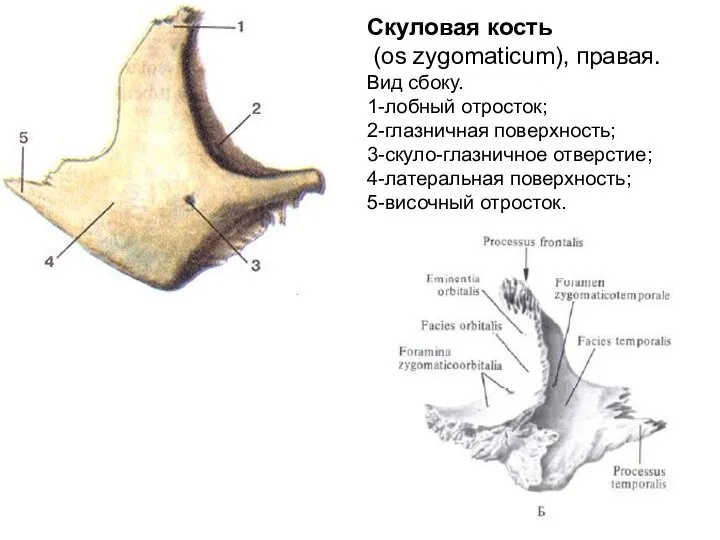 Скуловая кость (os zygomaticum), правая. Вид сбоку. 1-лобный отросток; 2-глазничная поверхность; 3-скуло-глазничное