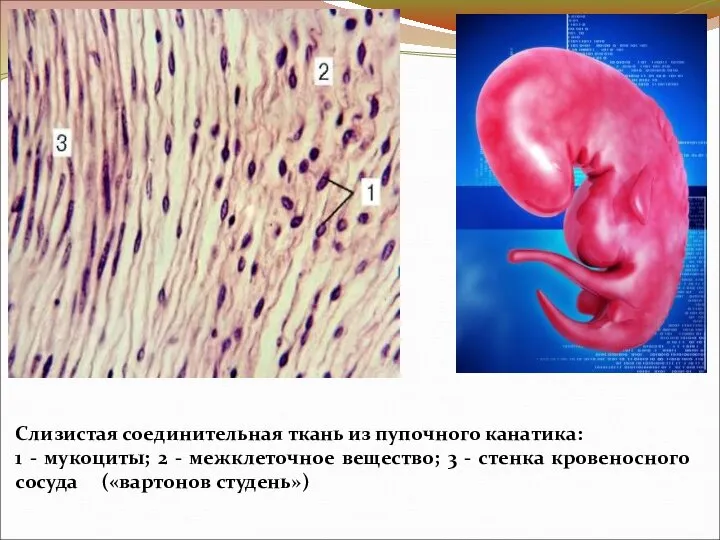 Слизистая соединительная ткань из пупочного канатика: 1 - мукоциты; 2 - межклеточное
