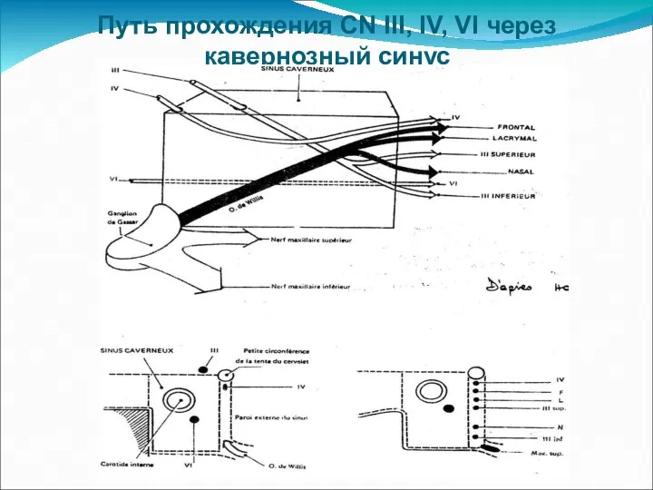 Путь прохождения CN III, IV, VI через кавернозный синус