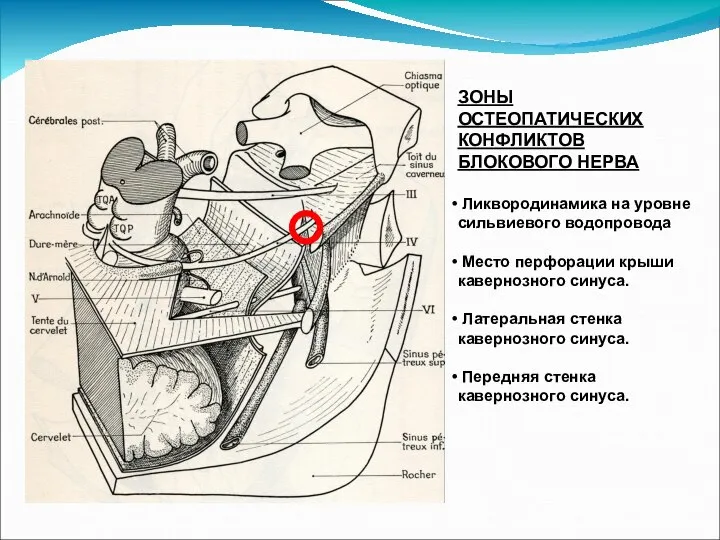 ЗОНЫ ОСТЕОПАТИЧЕСКИХ КОНФЛИКТОВ БЛОКОВОГО НЕРВА Ликвородинамика на уровне сильвиевого водопровода Место перфорации