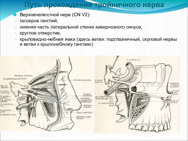 Путь прохождения тройничного нерва Верхнечелюстной нерв (CN V2): гассеров ганглий, нижняя часть