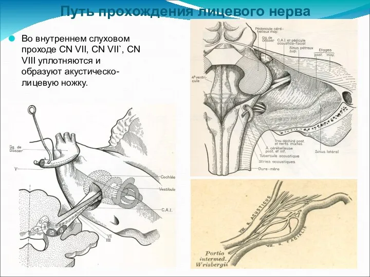 Путь прохождения лицевого нерва Во внутреннем слуховом проходе CN VII, CN VII`,