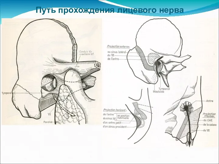 Путь прохождения лицевого нерва