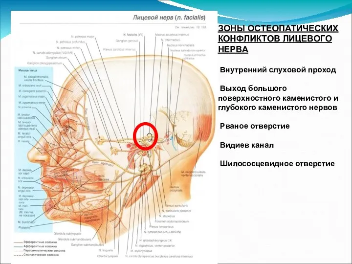 ЗОНЫ ОСТЕОПАТИЧЕСКИХ КОНФЛИКТОВ ЛИЦЕВОГО НЕРВА Внутренний слуховой проход Выход большого поверхностного каменистого