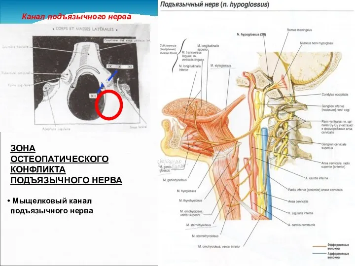 Канал подъязычного нерва ЗОНА ОСТЕОПАТИЧЕСКОГО КОНФЛИКТА ПОДЪЯЗЫЧНОГО НЕРВА Мыщелковый канал подъязычного нерва