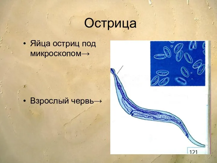 Острица Яйца остриц под микроскопом→ Взрослый червь→