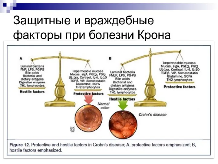 Защитные и враждебные факторы при болезни Крона