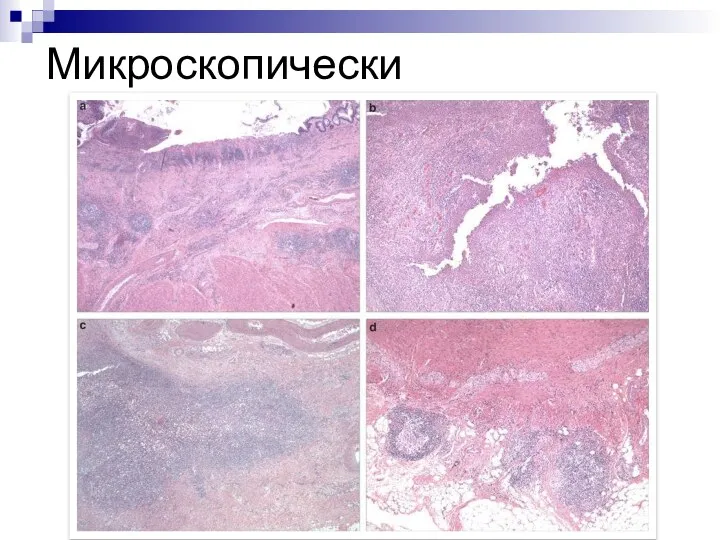 Микроскопически