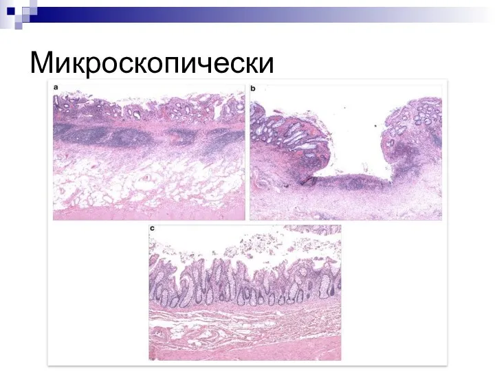 Микроскопически