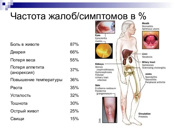 Частота жалоб/симптомов в %