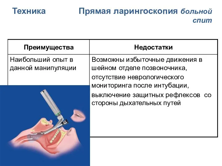 Техника Прямая ларингоскопия больной спит