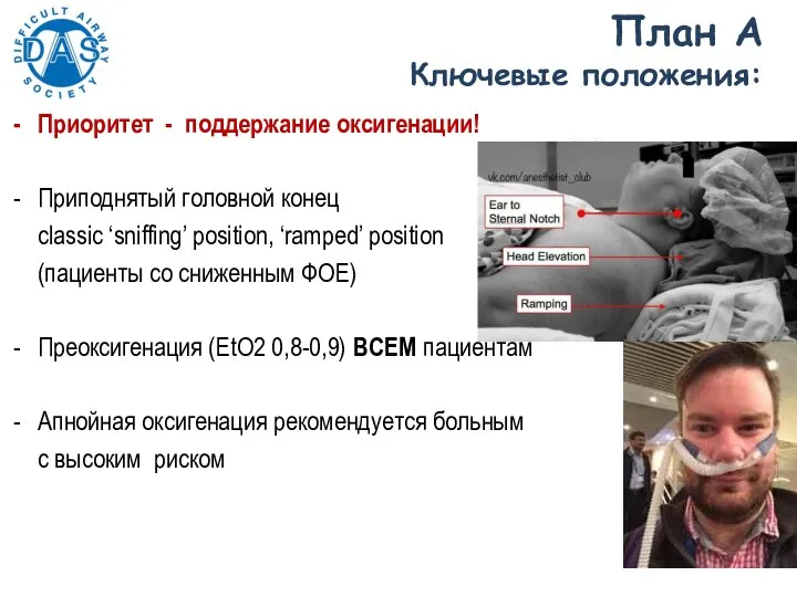 План A Ключевые положения: Приоритет - поддержание оксигенации! Приподнятый головной конец classic