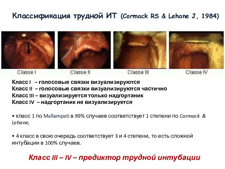 Классификация трудной ИТ (Cormack RS & Lehane J, 1984) Класс I –